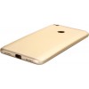 BeCover 3 в 1 Series для Xiaomi Mi Max 2 Gold (701590) - зображення 4