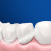 Oral-B Vitality D103 PRO Protect X Clean D103.413.3 Black - зображення 6