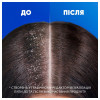 Head & Shoulders Шампунь  Заспокійливий догляд проти лупи 400 мл (8006540596289) - зображення 5